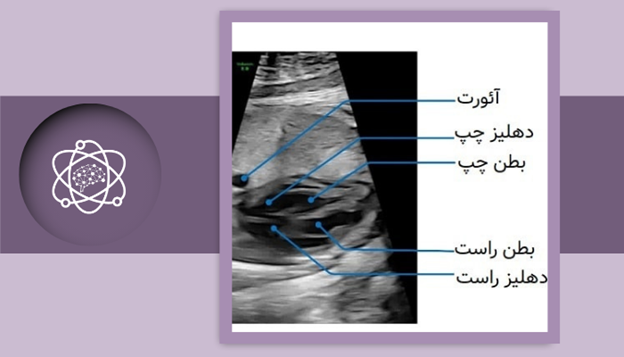 کاربردهای سونوگرافی فرکانس قلب جنین