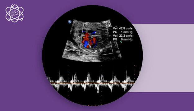 در سونوگرافی جنین FHR چیست و به چه معناست ؟ راهنمای کامل 