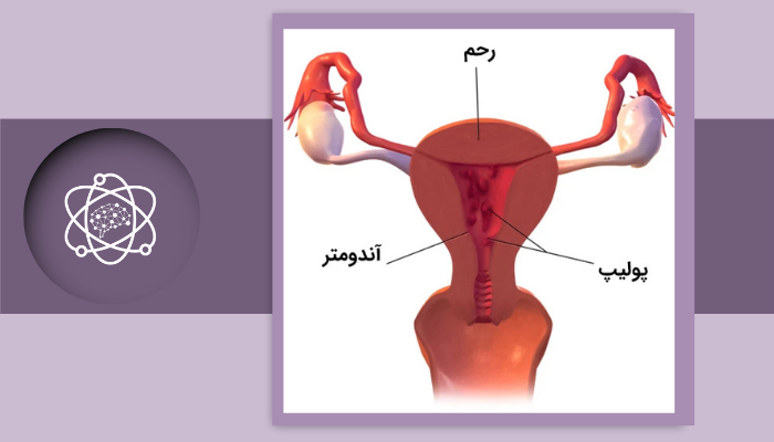 بررسی آندومتر در سونوگرافی چگونه انجام می‌شود؟